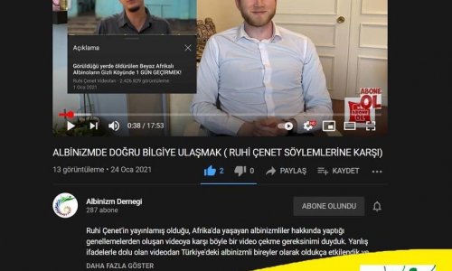 ALBİNİZİMDE DOĞRU BİLGİYE ULAŞMAK